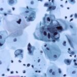 OPS alerta sobre mala gestión del 70% de residuos hospitalarios en América Latina