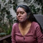 Carmela Juárez recibe tratamientos gratuitos tras sobrevivir a ataque con gasolina en Oaxaca